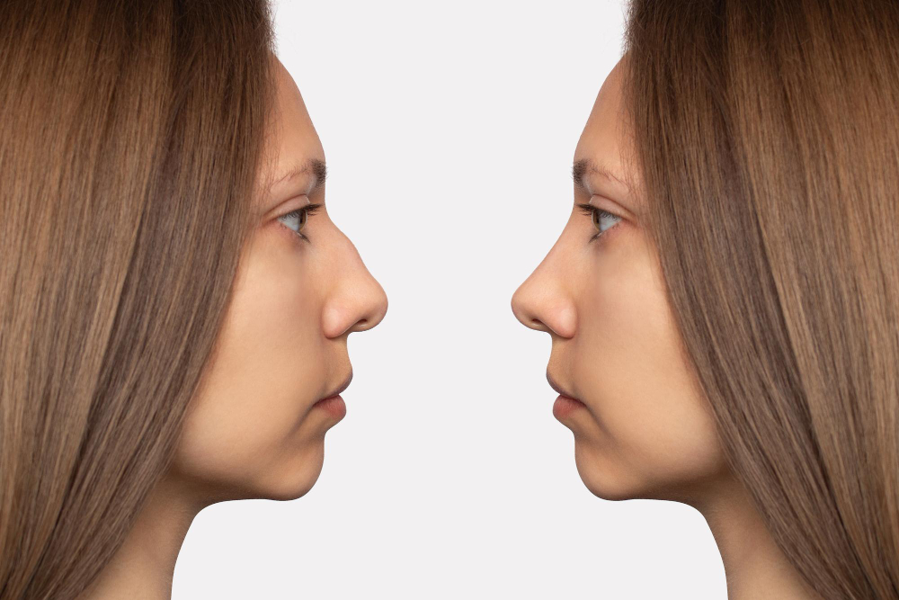 Cirujanos Plásticos en Colombia | Inicio Cirujanos Plásticos en Colombia|Inicio