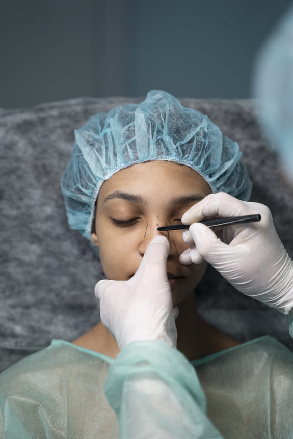 Beneficios de la rinoplastia